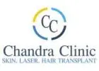 Chandra Clinic - Hair Transplant Clinic, Surgeon in Delhi | PRP Treatment in Delhi