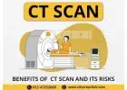 CT Scan Near Me At Affordable Price In Delhi NCR