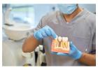 Full Mouth Dental Implants in Mexico with Teeth Savers