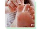 Plantar Wart Doctor Near Me Perth Amboy